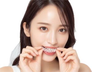 インビザラインのマウスピースを装着する女性